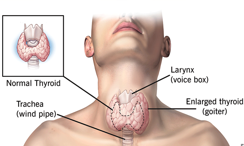understanding the thyroid